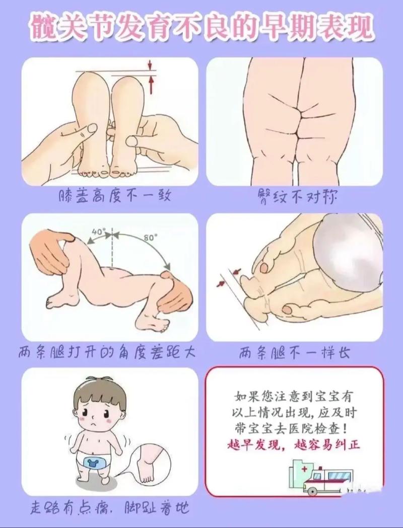  宝宝～腿趴开一点就不会疼，如何让宝宝更舒适？